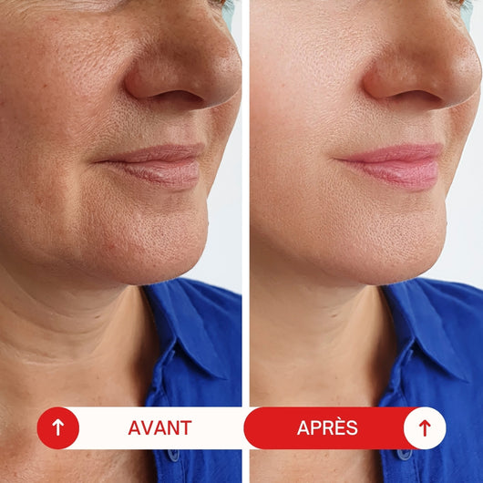 Soin Réparateur Lèvres au collagène