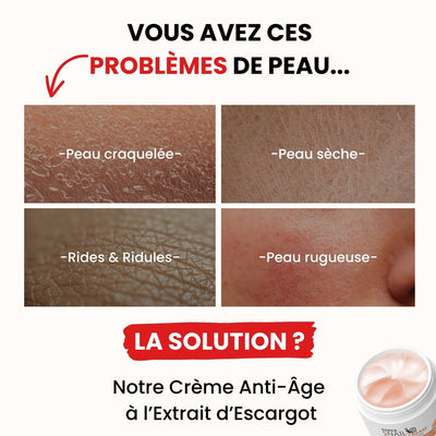 Crème Anti-Âge à l’Extrait d’Escargot