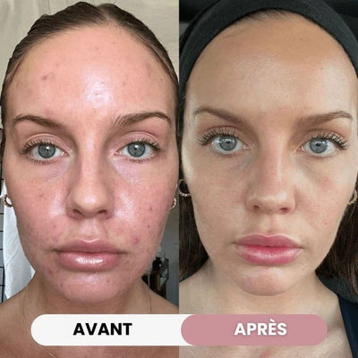 Crème au Collagène