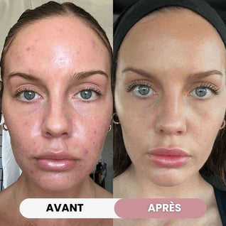 Crème au Collagène