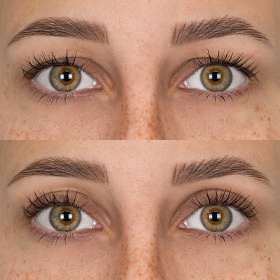 Patchs Lift Paupières